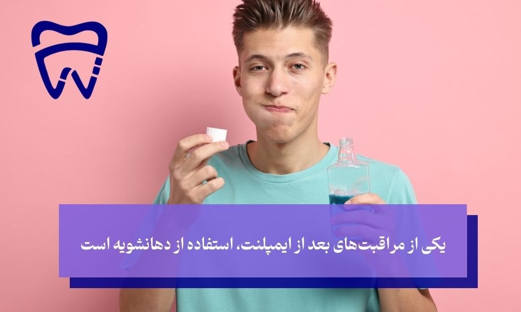 برای مراقبت از جدیدترین روش ایمپلنت از دهانشویه استفاده کنید