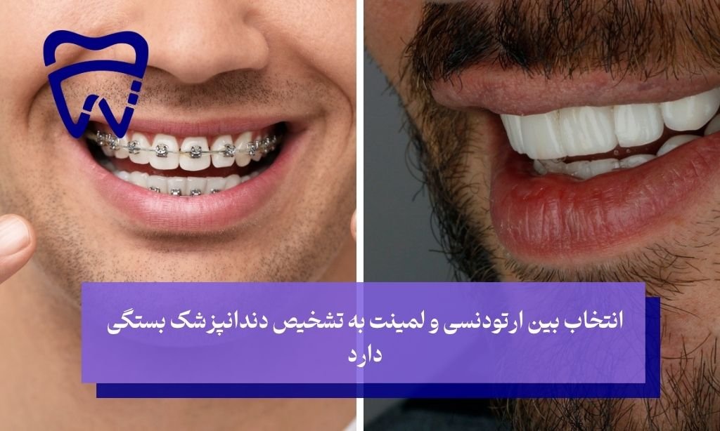 ارتودنسی بهتر است یا لمینت