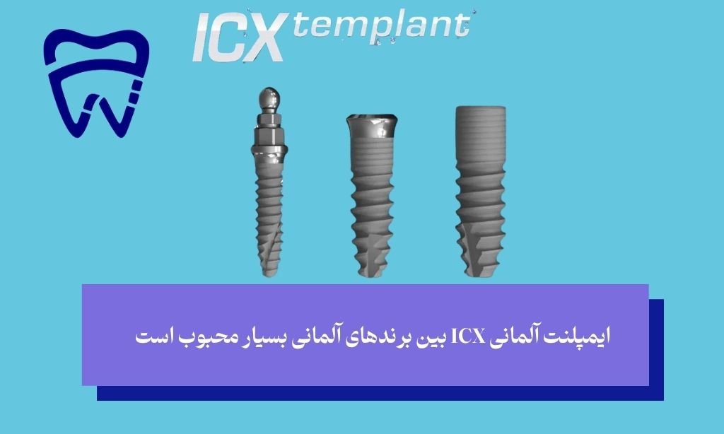 ایمپلنت آلمانی ICX