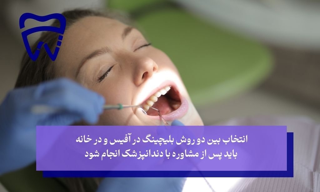 

تفاوت حیاتی؛ بلیچینگ آفیس در مقابل بلیچینگ در خانه