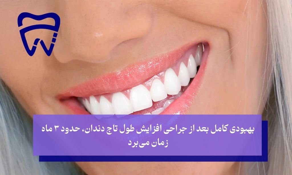 دوره بهبودی پس از جراحی