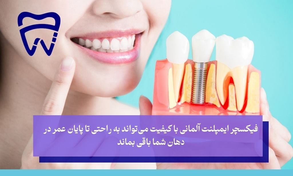 عمر ایمپلنت آلمانی