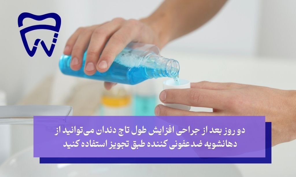 مراقبت های بعد از جراحی افزایش طول تاج